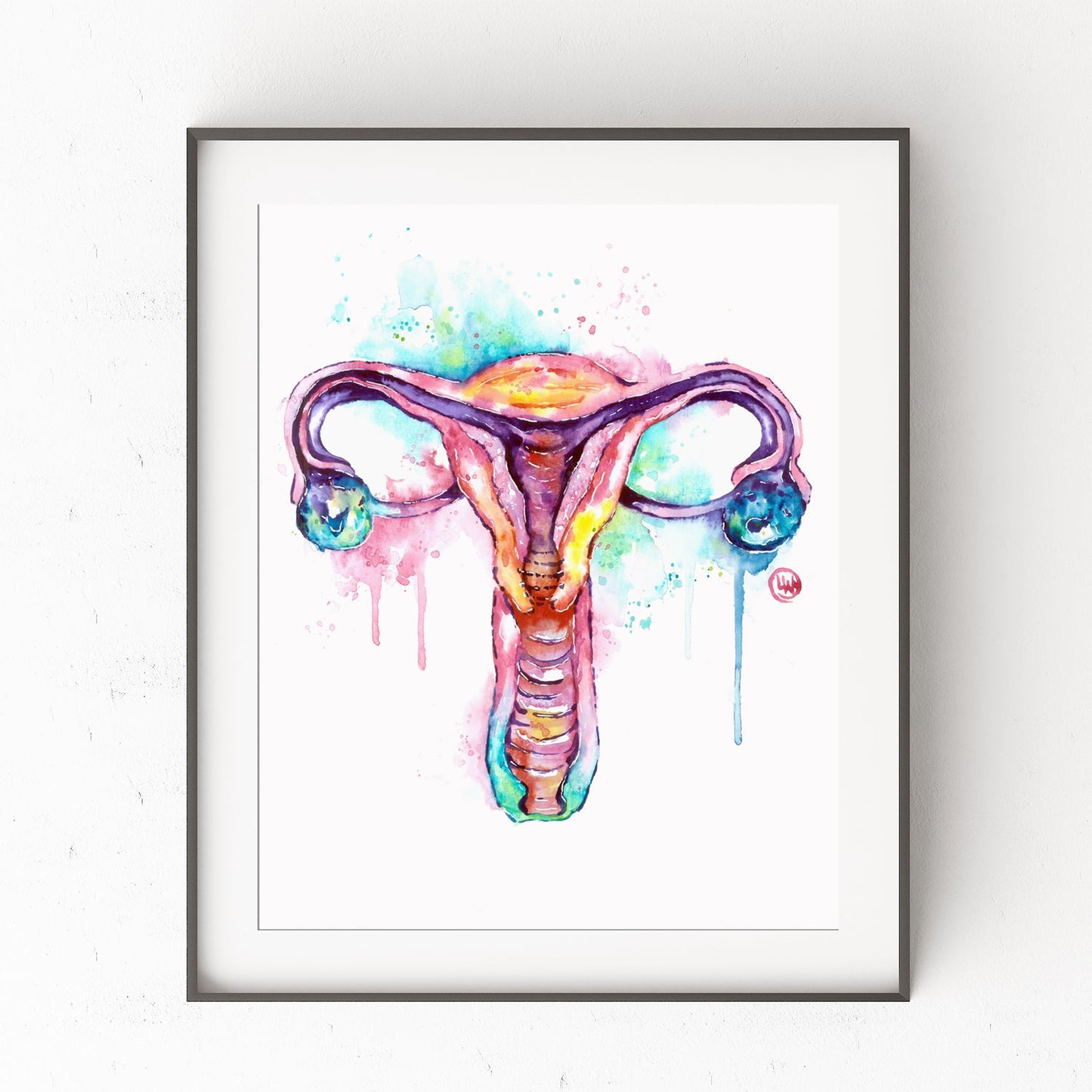 Anatomy Art - Uterus - 0