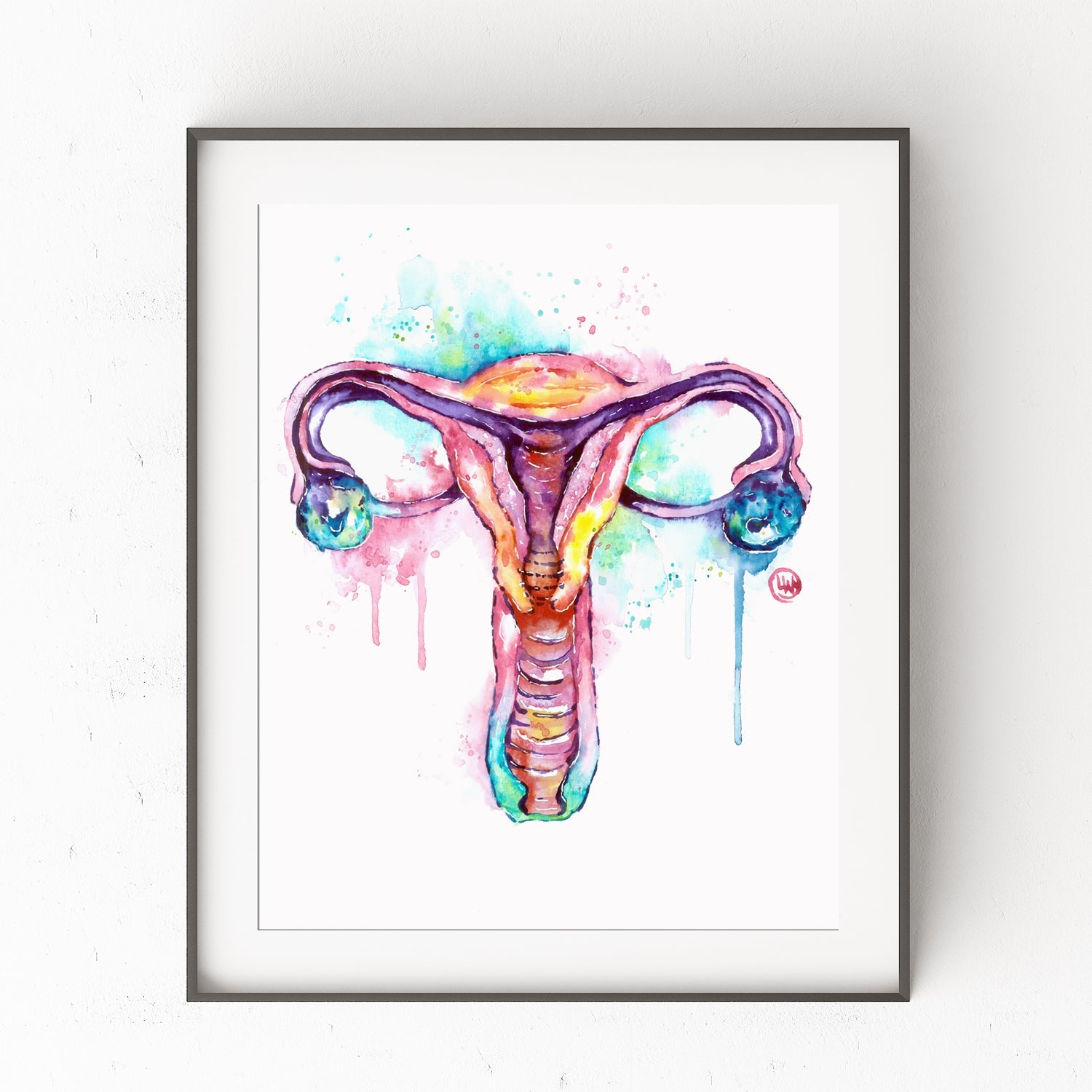 Anatomy Art - Uterus - 0